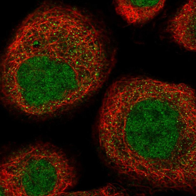 UEVLD Antibody in Immunocytochemistry (ICC/IF)