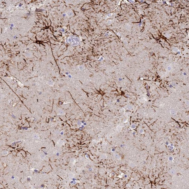 STK25 Antibody in Immunohistochemistry (Paraffin) (IHC (P))