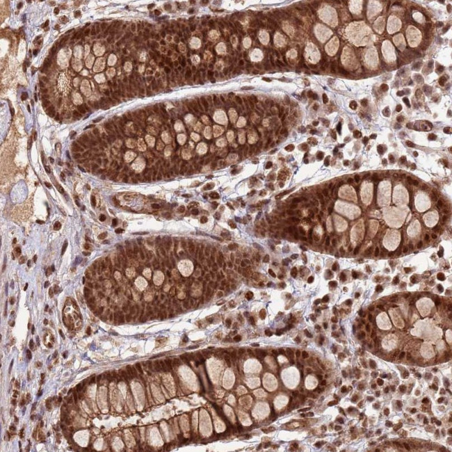 ZBTB12 Antibody in Immunohistochemistry (Paraffin) (IHC (P))