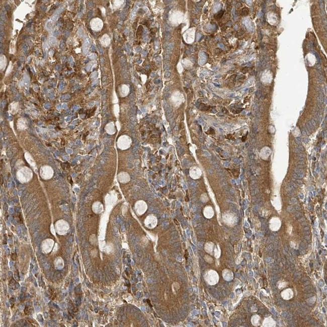 ARPIN Antibody in Immunohistochemistry (IHC)