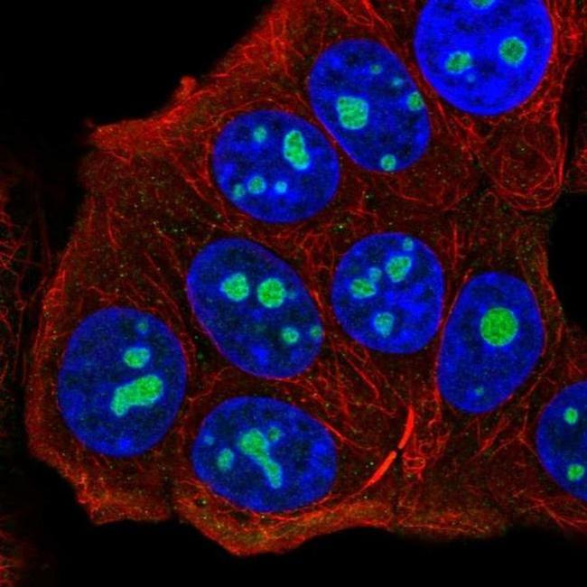 UTP14C Antibody in Immunocytochemistry (ICC/IF)