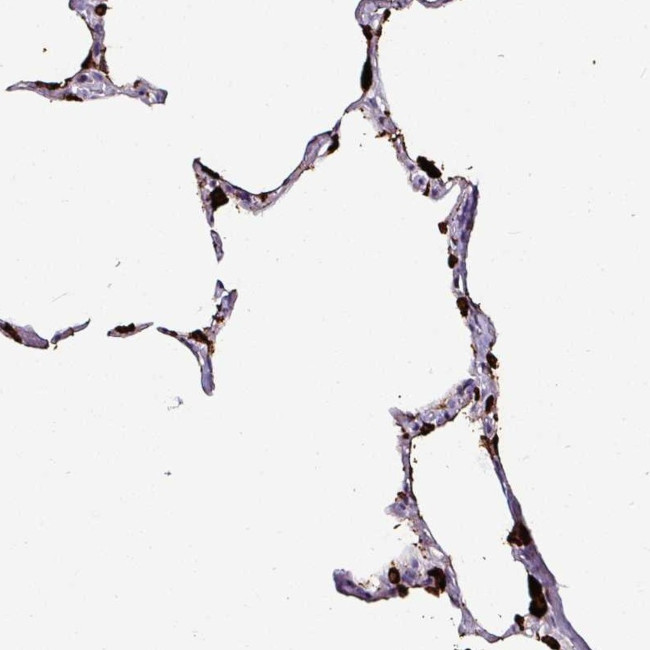 NAPSA Antibody in Immunohistochemistry (Paraffin) (IHC (P))