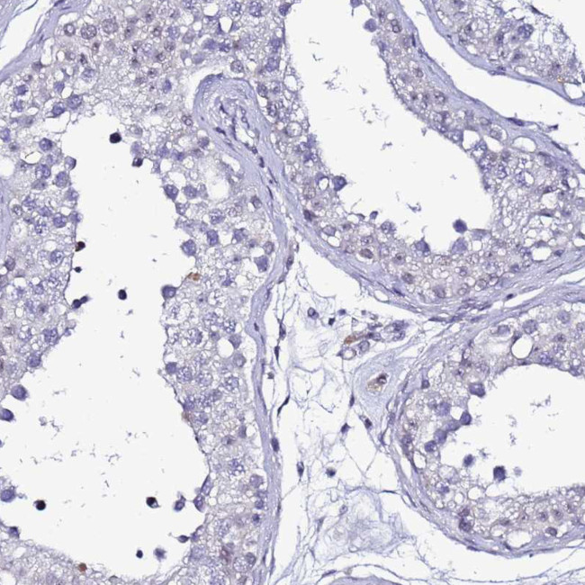 PSMA7 Antibody in Immunohistochemistry (Paraffin) (IHC (P))