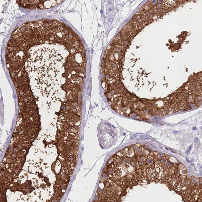 OR11H1 Antibody in Immunohistochemistry (Paraffin) (IHC (P))