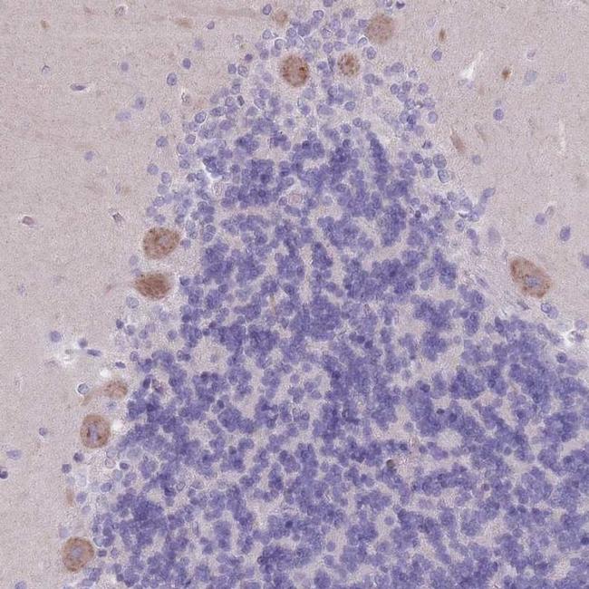 PIGM Antibody in Immunohistochemistry (IHC)