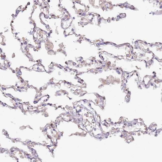 HSD17B7 Antibody in Immunohistochemistry (IHC)