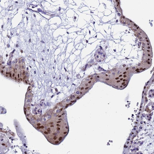 POP5 Antibody in Immunohistochemistry (Paraffin) (IHC (P))