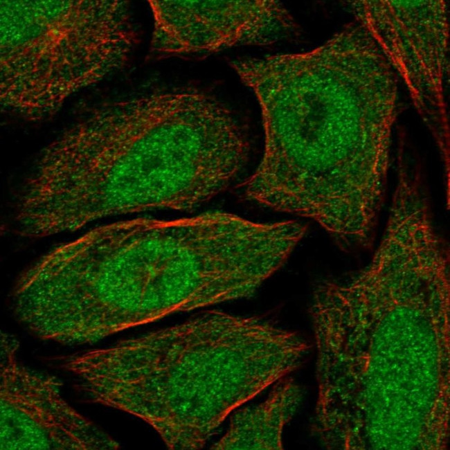 CABYR Antibody in Immunocytochemistry (ICC/IF)