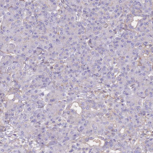 Alcohol Dehydrogenase 1A Antibody in Immunohistochemistry (Paraffin) (IHC (P))