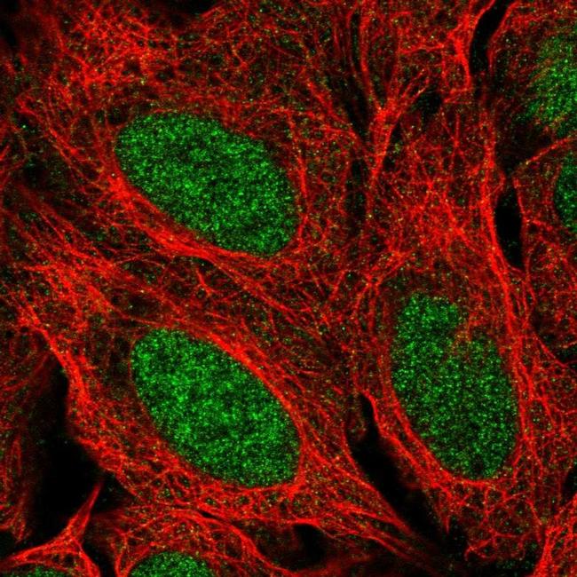 PPP1R17 Antibody in Immunocytochemistry (ICC/IF)