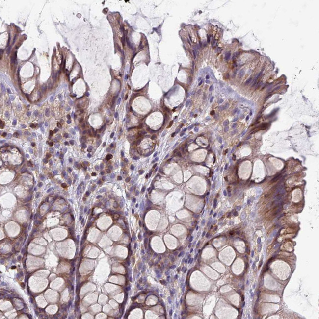 RAC1/RAC2/RAC3 Antibody in Immunohistochemistry (Paraffin) (IHC (P))