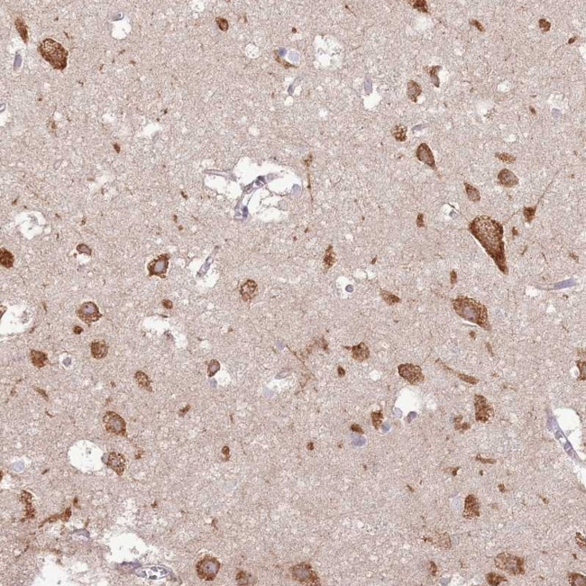 UGGT2 Antibody in Immunohistochemistry (Paraffin) (IHC (P))