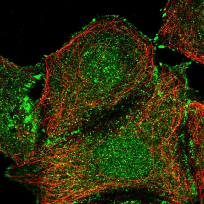 eIF2b beta Antibody in Immunocytochemistry (ICC/IF)