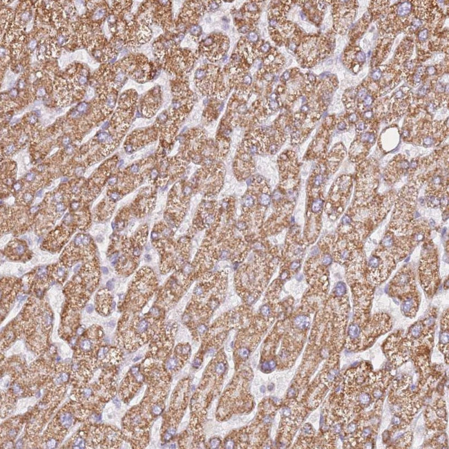 ZNF584 Antibody in Immunohistochemistry (Paraffin) (IHC (P))