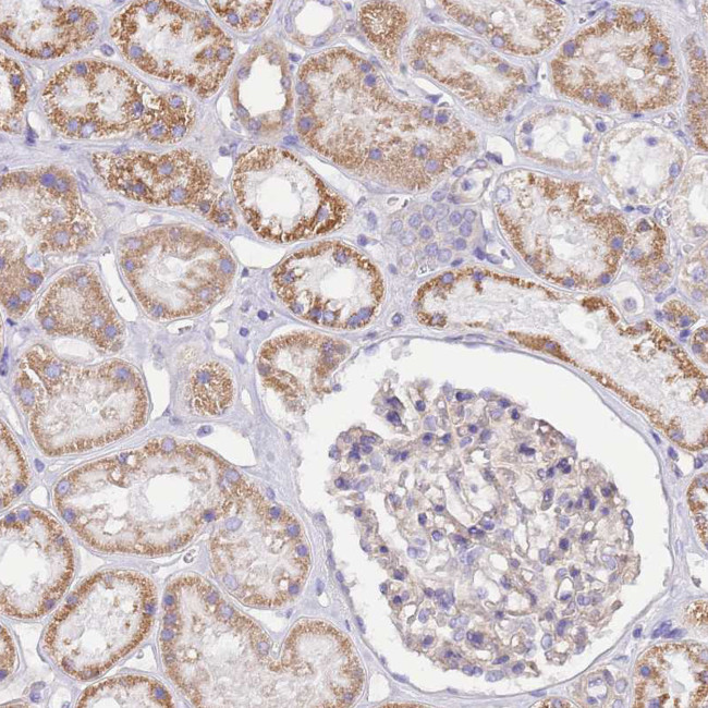 TDE1 Antibody in Immunohistochemistry (Paraffin) (IHC (P))