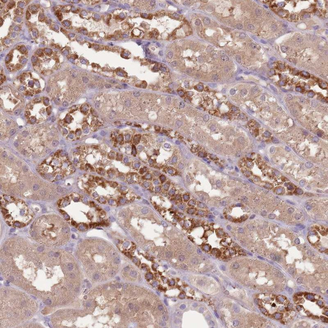 FECH Antibody in Immunohistochemistry (Paraffin) (IHC (P))