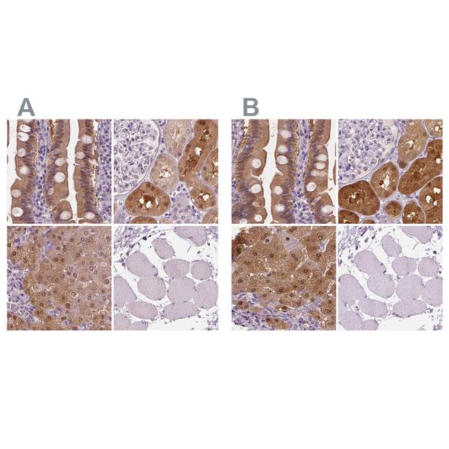 DAK Antibody in Immunohistochemistry (IHC)