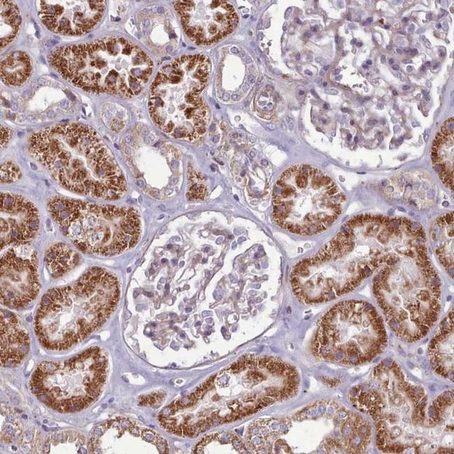 PAPD5 Antibody in Immunohistochemistry (IHC)