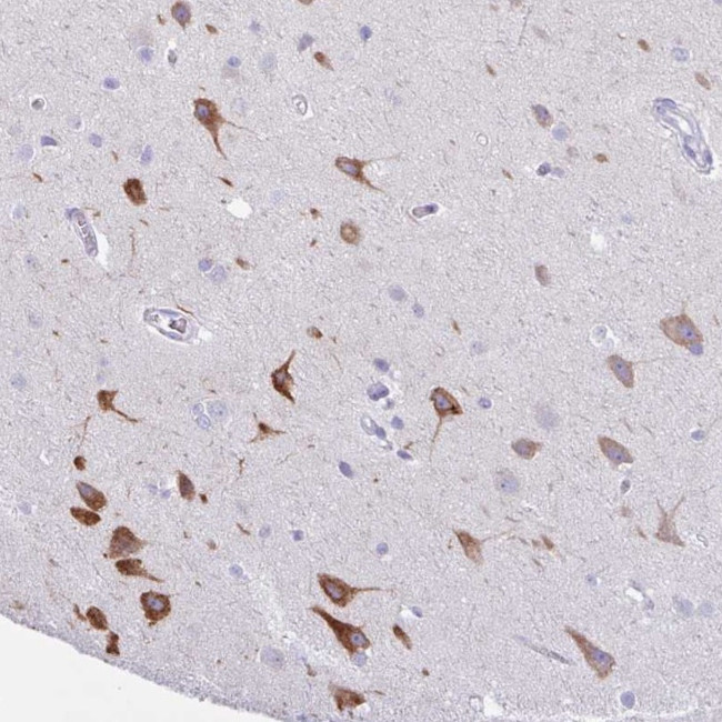 Argonaute 3 Antibody in Immunohistochemistry (Paraffin) (IHC (P))