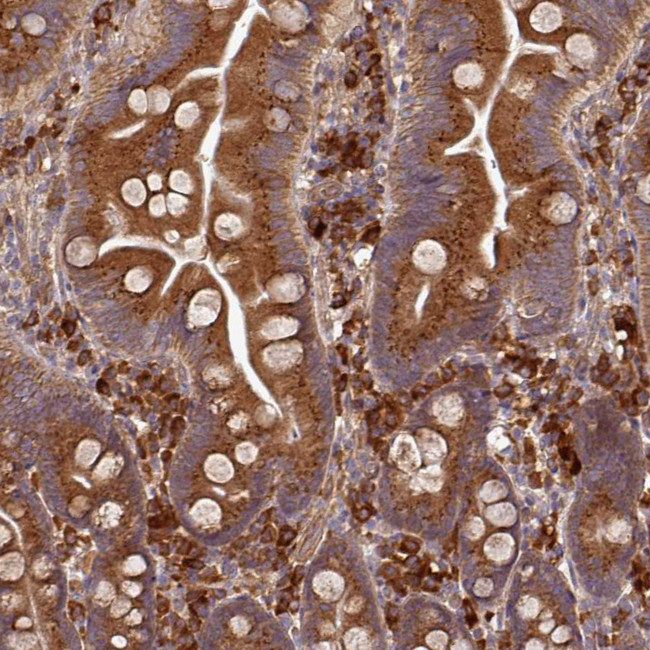 EDEM2 Antibody in Immunohistochemistry (Paraffin) (IHC (P))