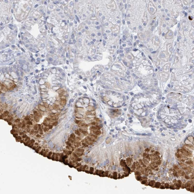 RAB33B Antibody in Immunohistochemistry (Paraffin) (IHC (P))