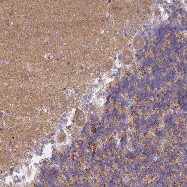 AP3M1 Antibody in Immunohistochemistry (Paraffin) (IHC (P))