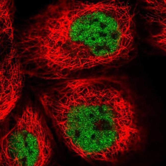 UBXN7 Antibody in Immunocytochemistry (ICC/IF)