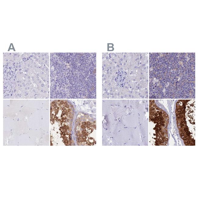 LZTFL1 Antibody in Immunohistochemistry (IHC)