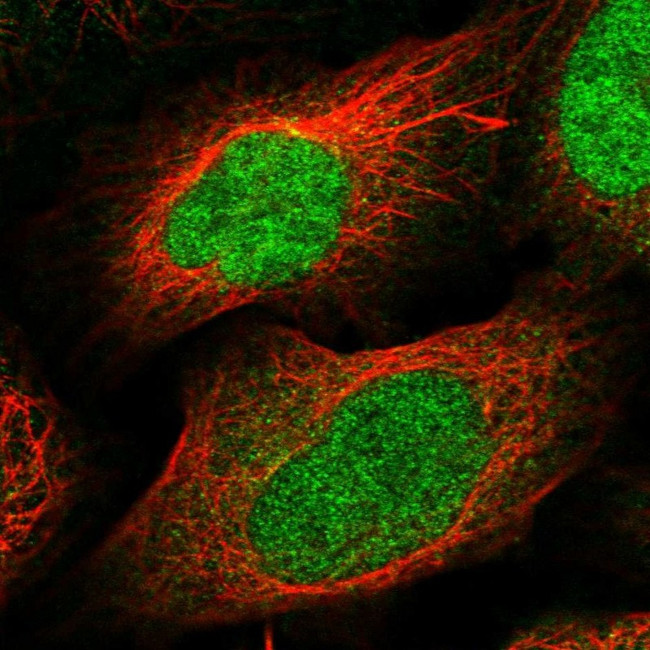 DBF4B Antibody in Immunocytochemistry (ICC/IF)