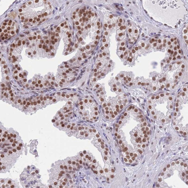 ZBED5 Antibody in Immunohistochemistry (Paraffin) (IHC (P))