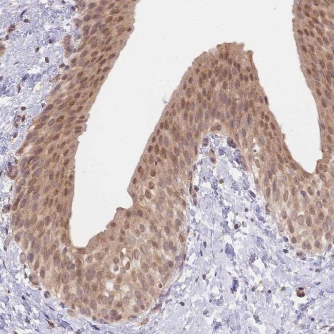 TMEM55B Antibody in Immunohistochemistry (IHC)