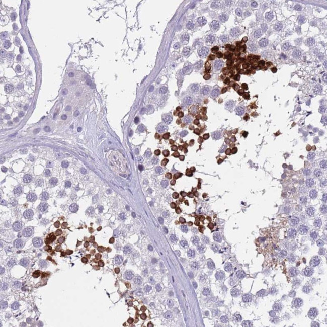 SPAG4L Antibody in Immunohistochemistry (Paraffin) (IHC (P))