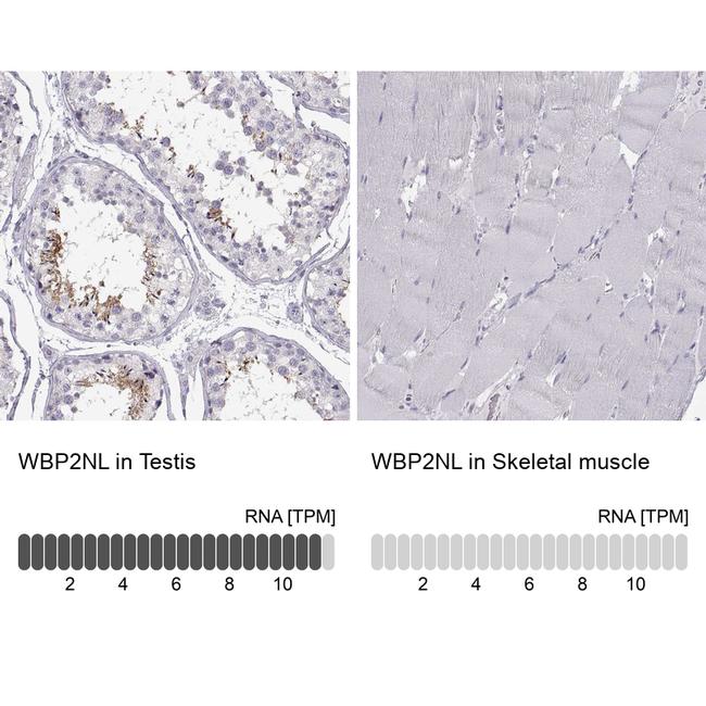 WBP2NL Antibody in Immunohistochemistry (IHC)