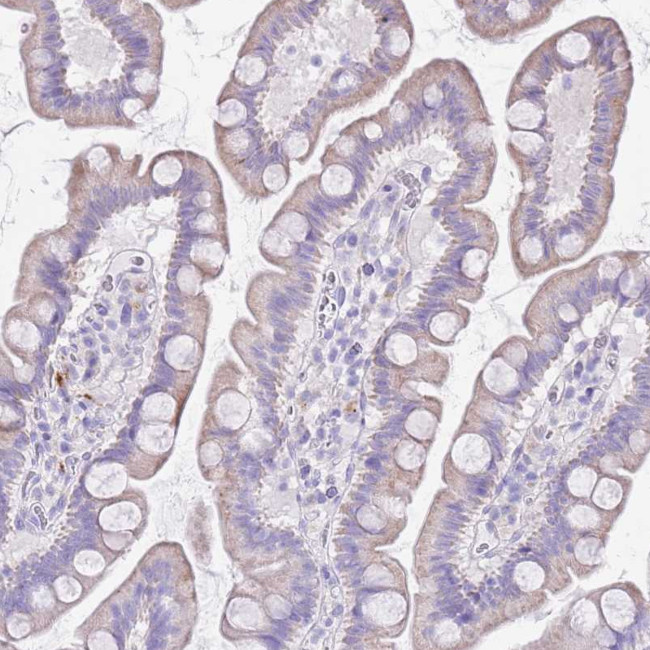 ABHD17C Antibody in Immunohistochemistry (Paraffin) (IHC (P))