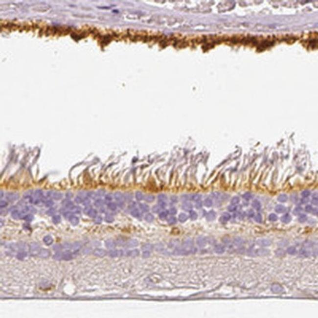 MYO3A Antibody in Immunohistochemistry (IHC)