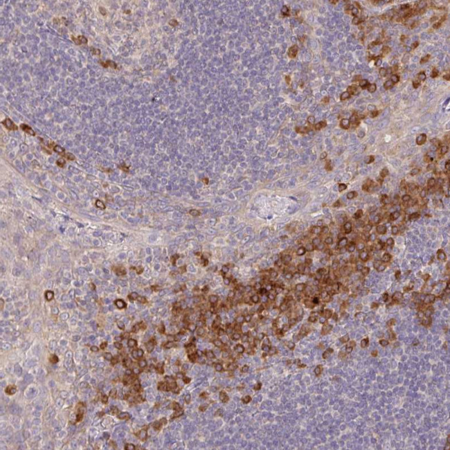 DERL2 Antibody in Immunohistochemistry (Paraffin) (IHC (P))