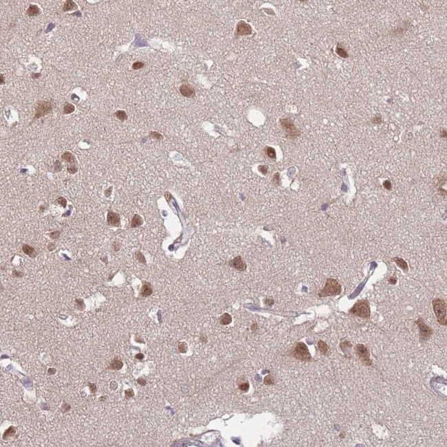 TFAP2D Antibody in Immunohistochemistry (Paraffin) (IHC (P))