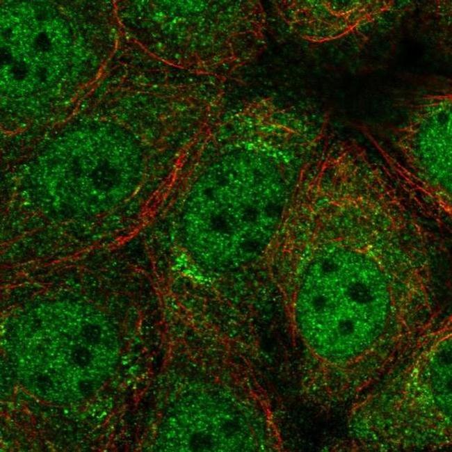 RFX2 Antibody in Immunocytochemistry (ICC/IF)