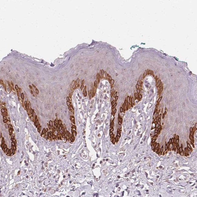 TUB Antibody in Immunohistochemistry (Paraffin) (IHC (P))