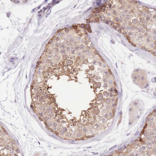 LIPH Antibody in Immunohistochemistry (Paraffin) (IHC (P))