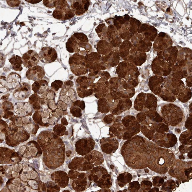 CPSF4 Antibody in Immunohistochemistry (Paraffin) (IHC (P))