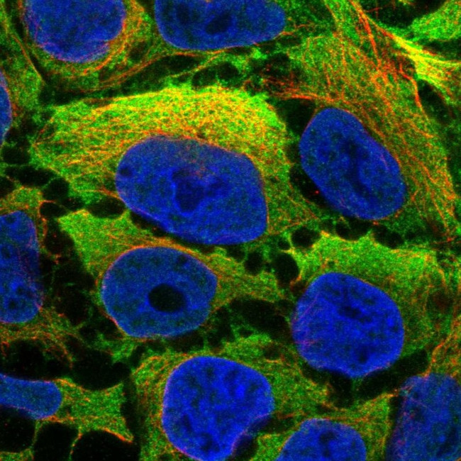 Calponin 2 Antibody in Immunocytochemistry (ICC/IF)