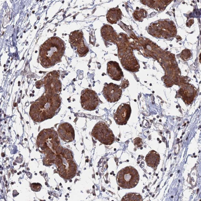 DGKD Antibody in Immunohistochemistry (Paraffin) (IHC (P))