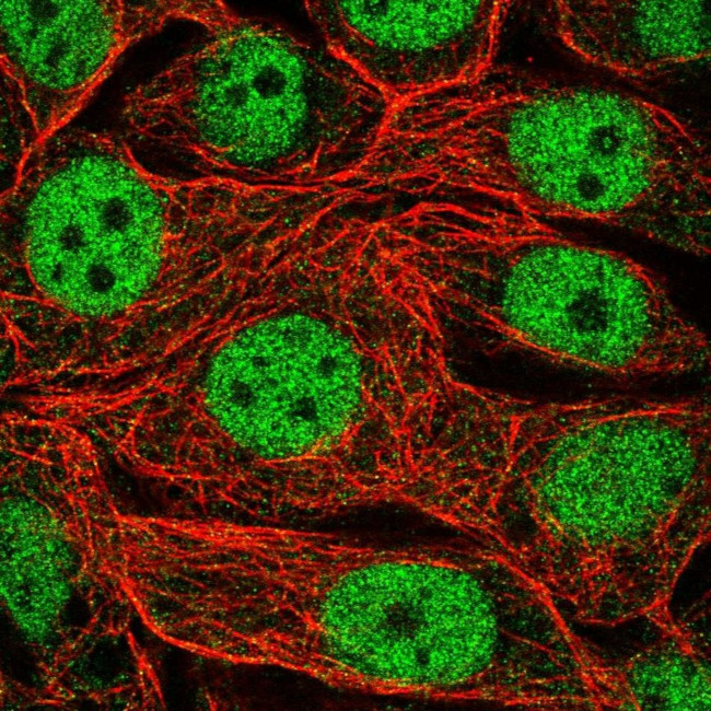 RFXANK Antibody in Immunocytochemistry (ICC/IF)