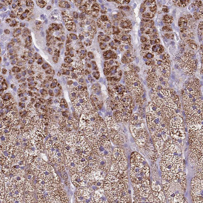 CYP11B2 Antibody in Immunohistochemistry (Paraffin) (IHC (P))