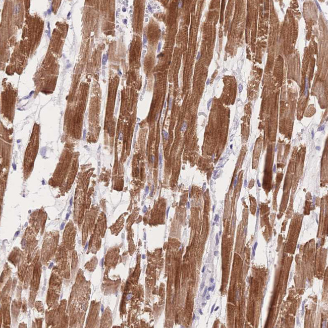 MYOM1 Antibody in Immunohistochemistry (Paraffin) (IHC (P))