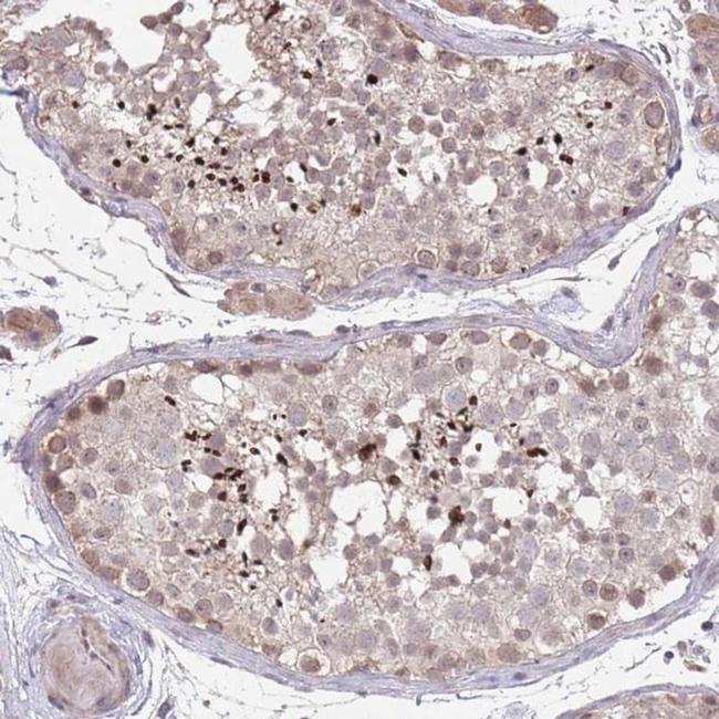 MEI1 Antibody in Immunohistochemistry (IHC)