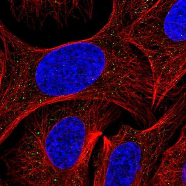 AP3S2 Antibody in Immunocytochemistry (ICC/IF)