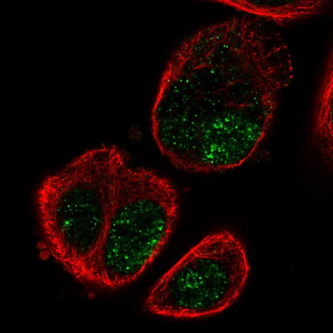 SLC16A9 Antibody in Immunocytochemistry (ICC/IF)