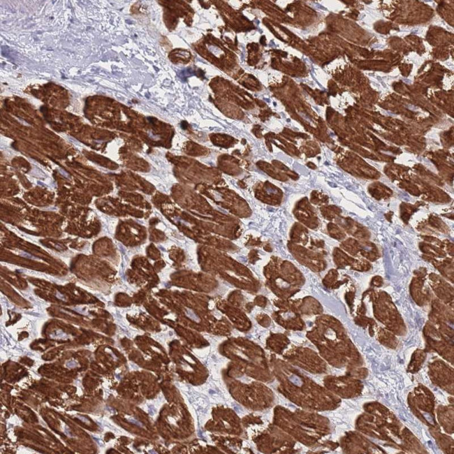 RNF4 Antibody in Immunohistochemistry (Paraffin) (IHC (P))